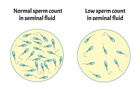 masumax for sperm count|Low sperm count .